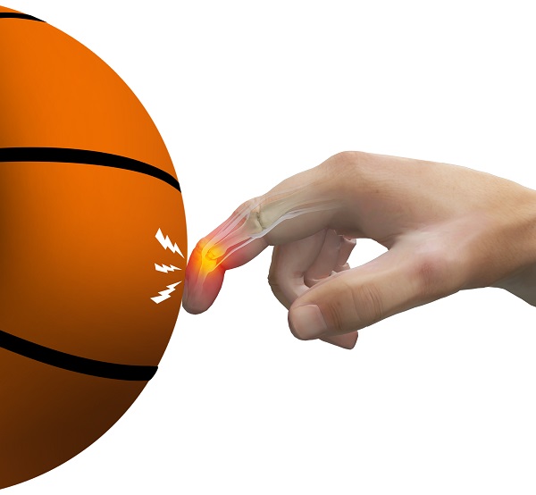 Should You Play Basketball With a Jammed Finger? Find Out the Pros and Cons.